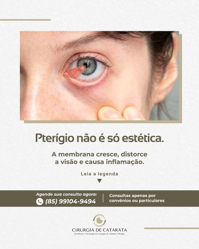 Instagram post from cirurgiacataratafortaleza. This post is in position 4.