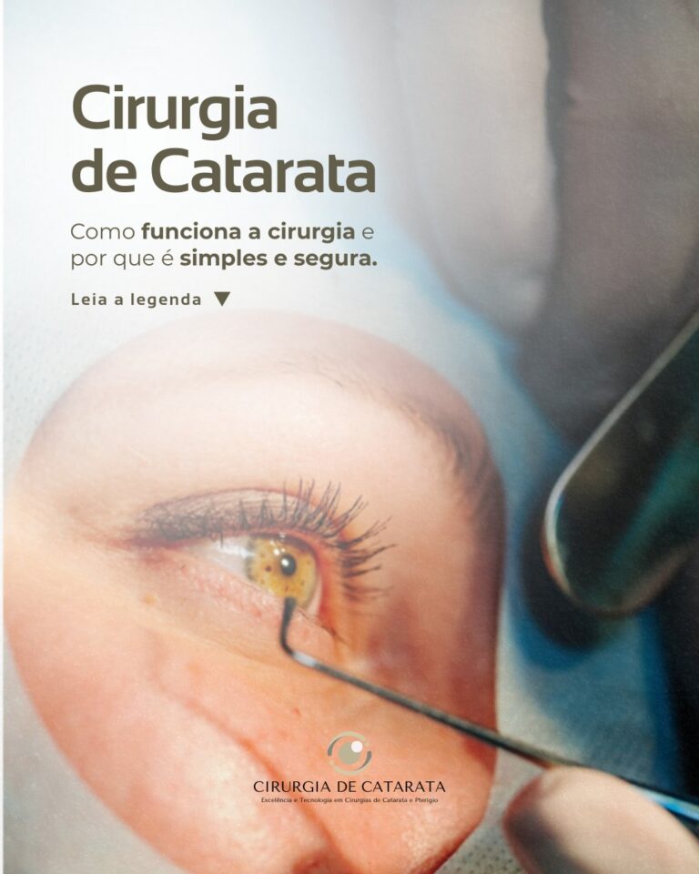 Instagram post from cirurgiacataratafortaleza. This post is in position 2.