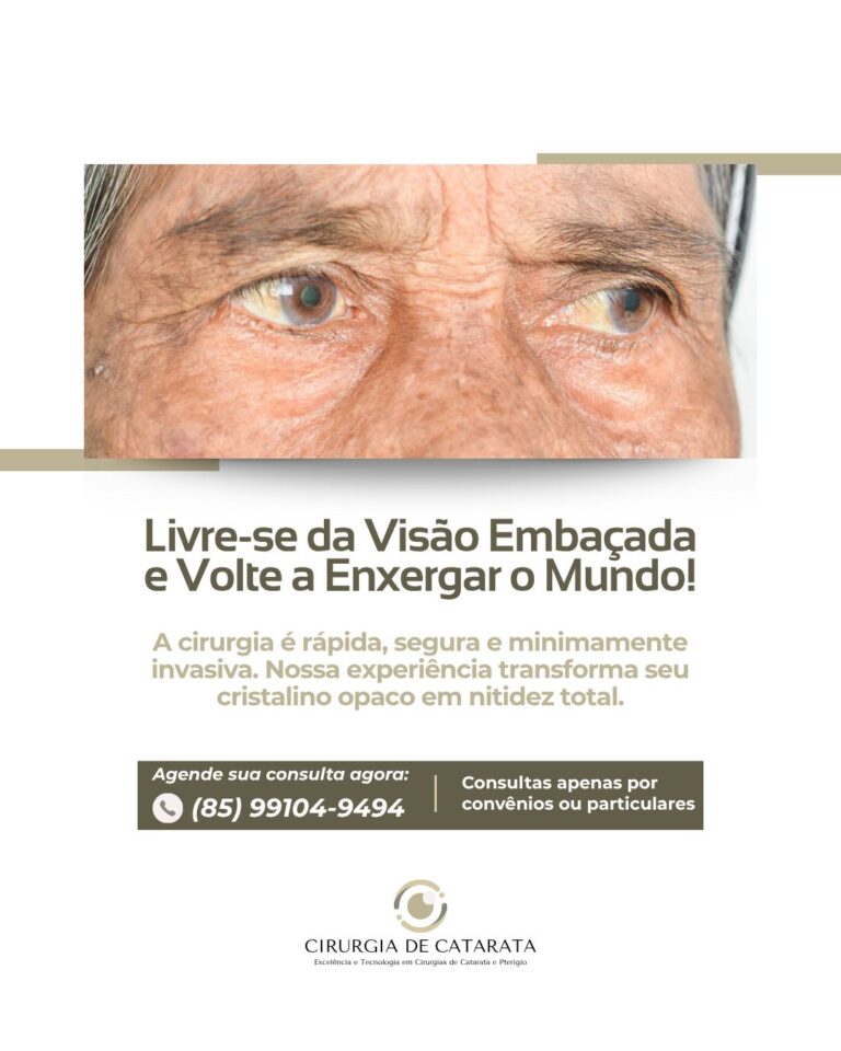 Instagram post from cirurgiacataratafortaleza. This post is in position 1.